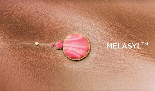 lorealden-cilt-lekelerine-karsi-cigir-acan-yeni-molekul-melasyl.jpg