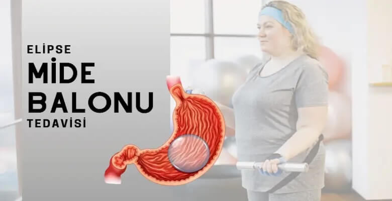 Yutulabilir Mide Balonu Fiyatı