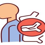 Kifoplasti Nedir? Omurga Kırıklarında Modern Tedavi Yöntemi