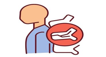 Kifoplasti Nedir? Omurga Kırıklarında Modern Tedavi Yöntemi